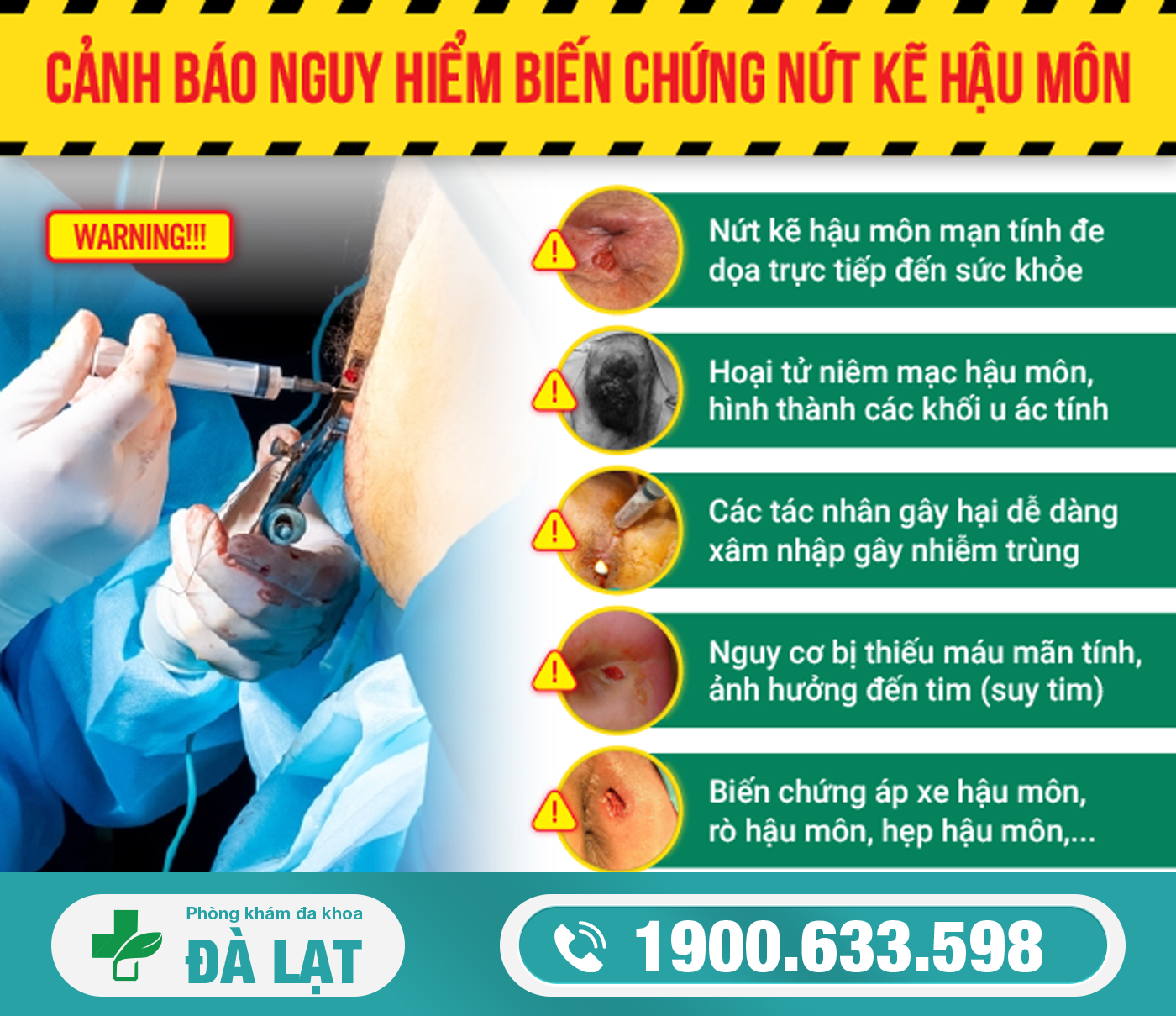 Hình ảnh minh họa
